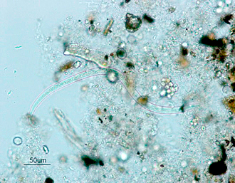 ばっ気槽などの微生物観察