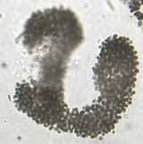 Microcystis aeruginos